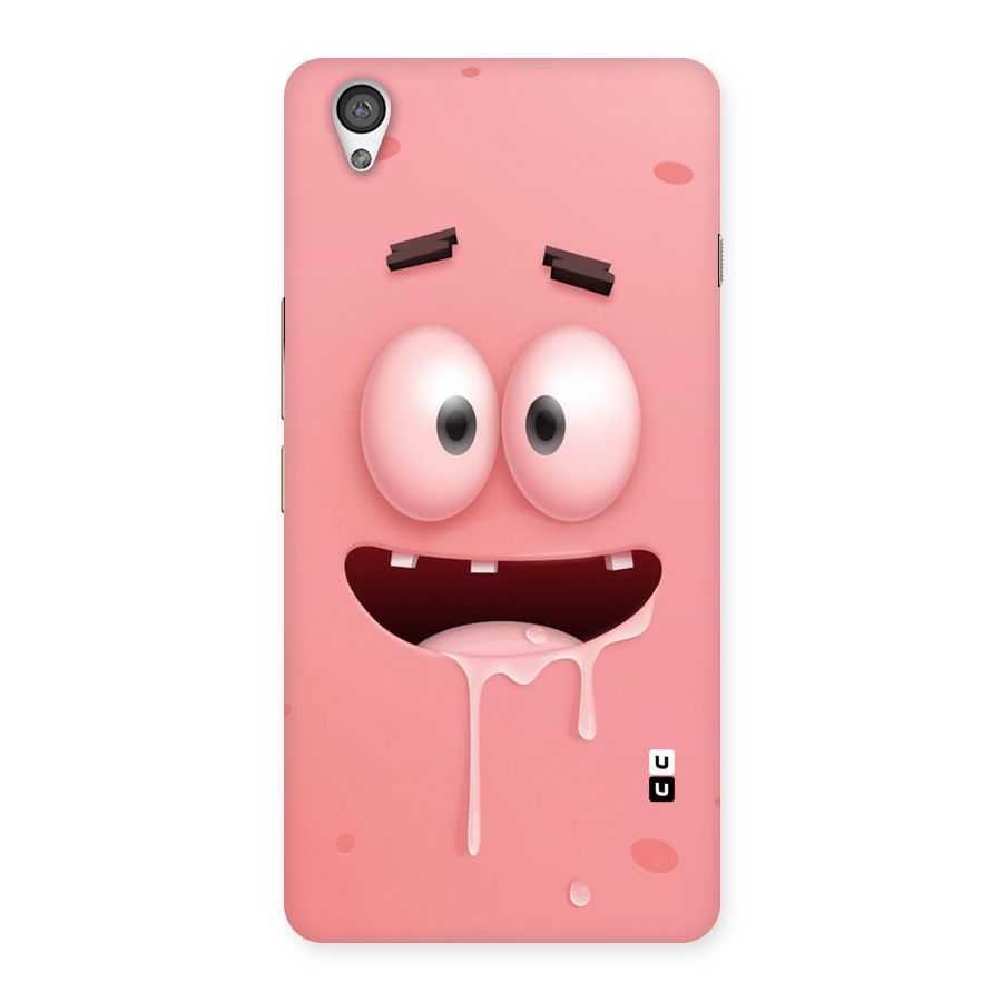 Watery Mouth Back Case for OnePlus X