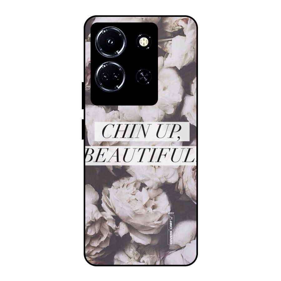 Chin Up Beautiful Metal Back Case for Infinix Note 30 5G