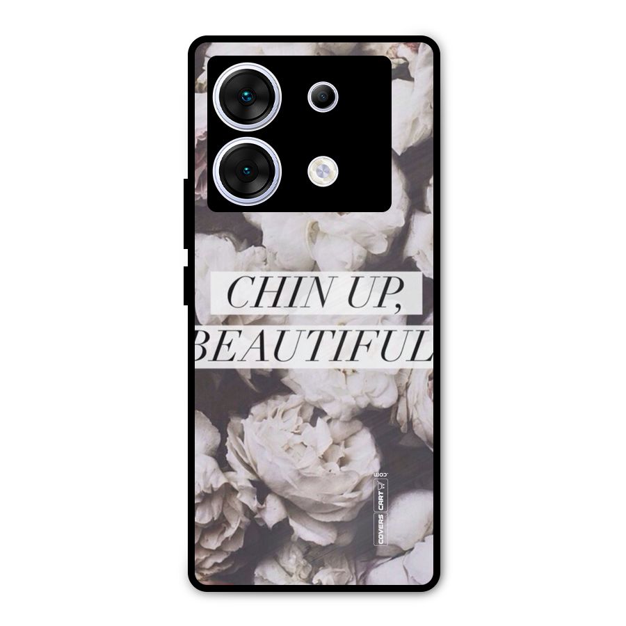 Chin Up Beautiful Metal Back Case for Infinix Zero 30 5G
