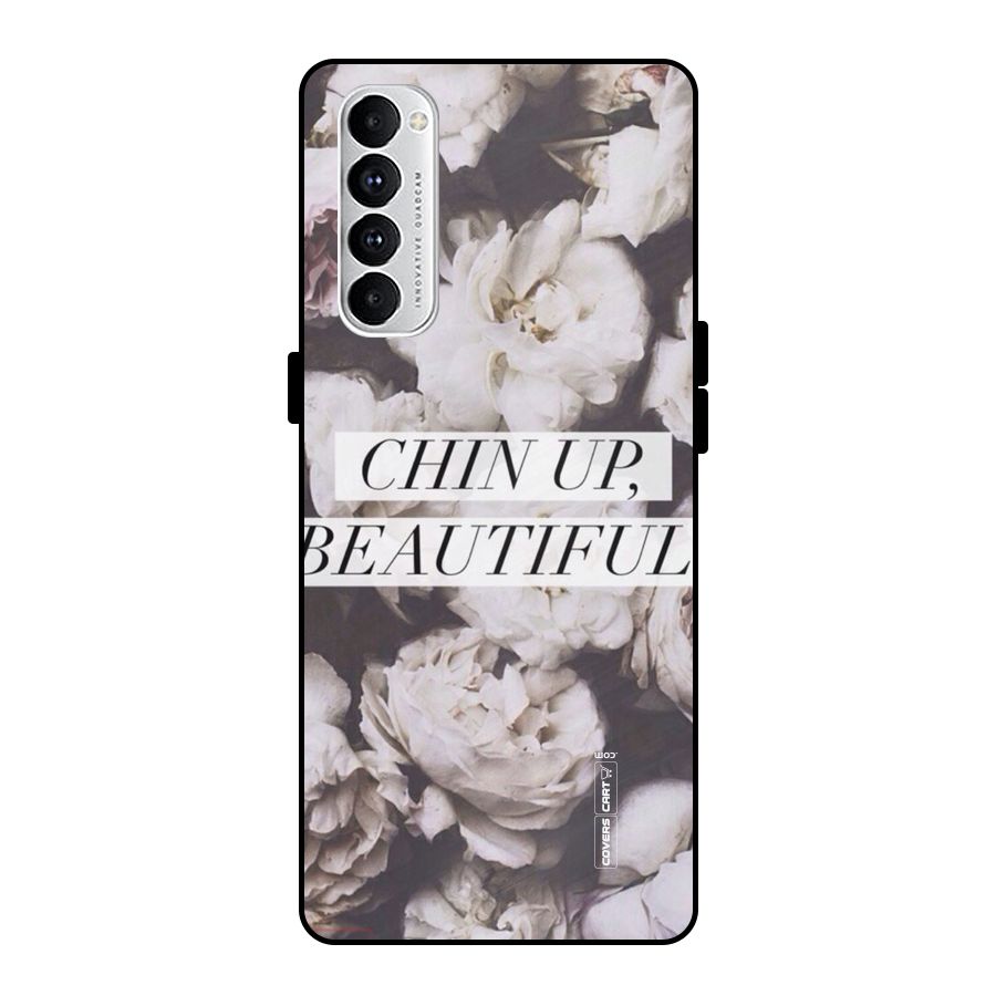 Chin Up Beautiful Metal Back Case for Oppo Reno4 Pro