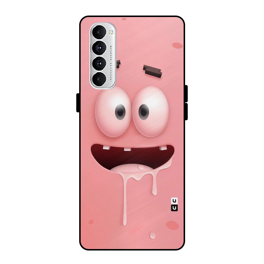 Watery Mouth Metal Back Case for Oppo Reno4 Pro