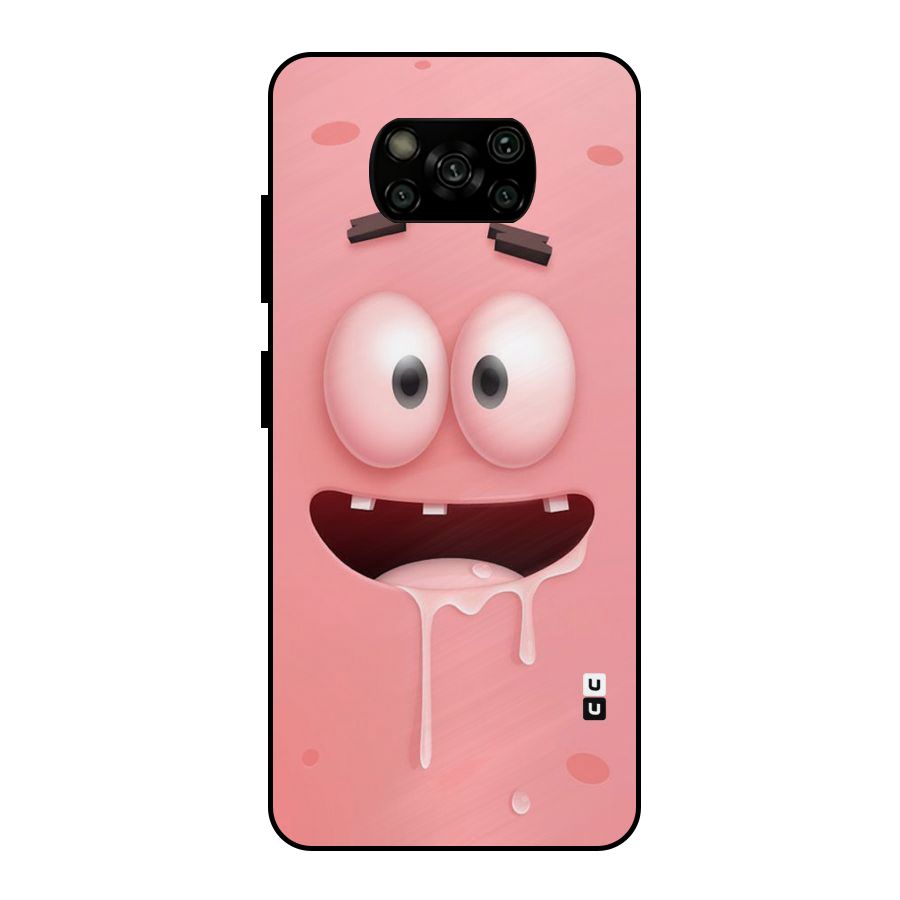 Watery Mouth Metal Back Case for Poco X3